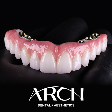 Zirconia Implant Bridge